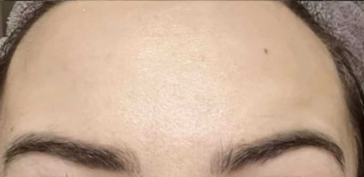After image